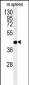 PGD Antibody (Center)